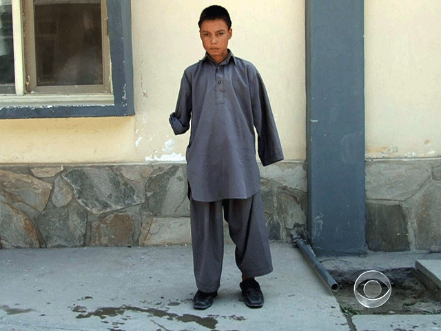 16-year-old Naragha lost both his hands last month when someone threw a grenade at a wedding he was attending.  