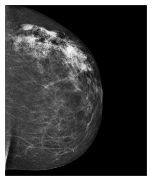 shea-hartman-mammogram.jpg 