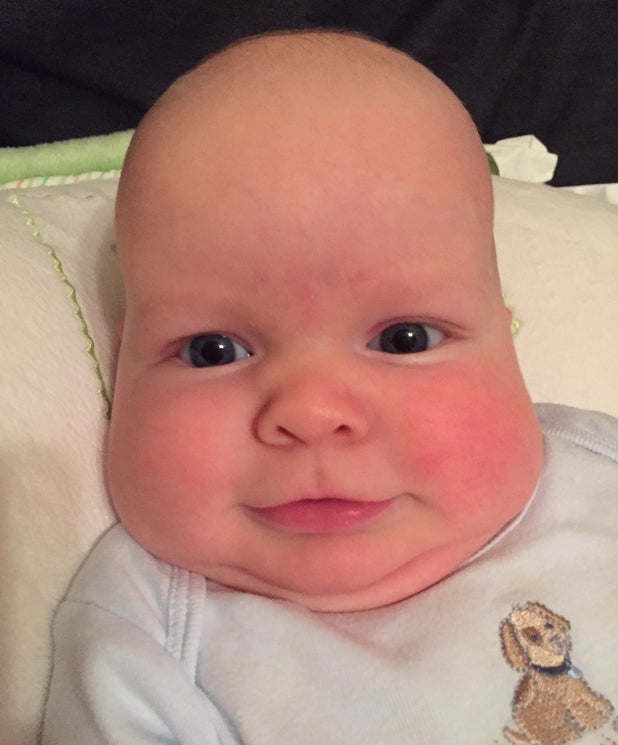 Baby’s odd head shape signaled serious medical condition - CBS News