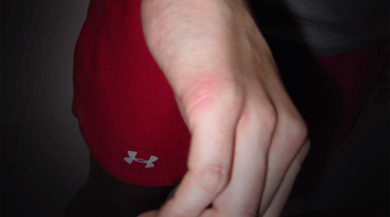 ​Police photographed marks on Taylor Gould's hand 