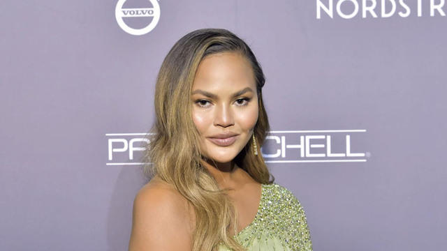 Chrissy Teigen says she had an abortion in 2020 