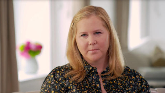 Amy Schumer says criticism of her face led to diagnosis