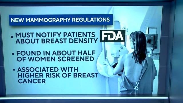 Medical Practitioners Will Have To Notify Patients About Breast Density ...