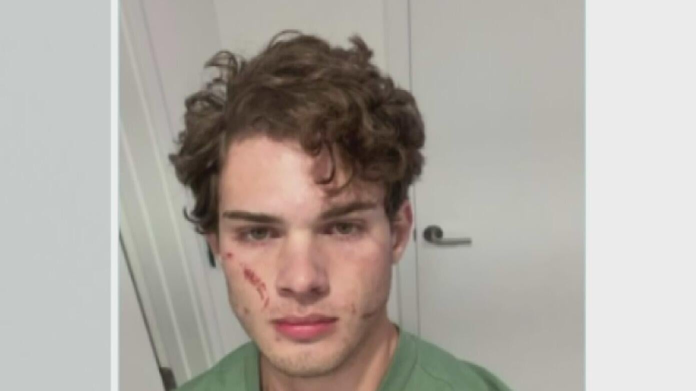 Clavicular suffers suspected overdose in Miami: 