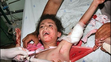 injured girl is treated by medics 