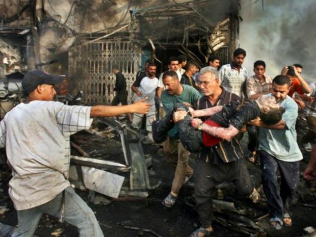 man is carried from the scene of a car bomb 