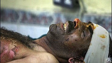 An Iraqi man injured in a parked car bomb explosion near an electricity office 