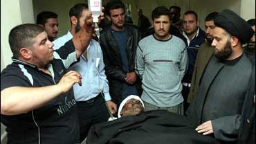 An Iraqi man injured in an explosion is treated at a hospital in Baghdad, Iraq, Saturday, Dec. 2, 2006. 