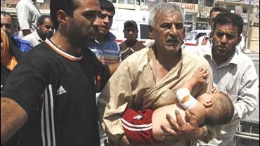 A baby injured in a mortar attack in Sadr City, Baghdad 