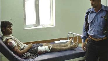 Iraqi injured by female suicide bomber 