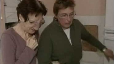 A French woman with a rare, painful and disfiguring facial tumour 