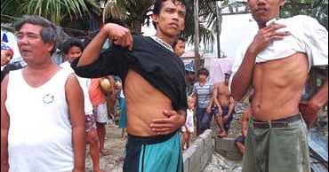 Philippines Bans Kidneys For Foreigners CBS News