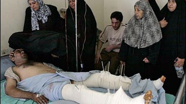 Qasim al Sudani, an Al Sadr city council member lies on a bed in hospital in Sadr city, Baghdad as relatives and friend stand next to him, on Tuesday, June 24, 2008. 
