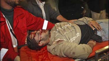 A wounded Palestinian is wheeled into hospital during an Israeli army raid, near Deir El Bahlah in the central Gaza Strip on Nov. 5, 2008. Israel launched an airstrike on Gaza early Wednesday after its troops clashed with Hamas militants who fired mortars 