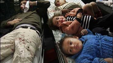 Children and a man injured in Dec. 27, 2008 Israel-Palestine fighting 