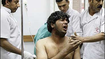 Injured Shiite pilgrim 