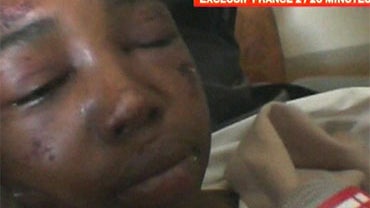 Bahia Bakari, aged 14, believed to be the only survivor of the Yemenia Airbus 310 crash is brought back to France on a French Government plane. 