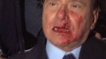 Berlusconi hit in face 