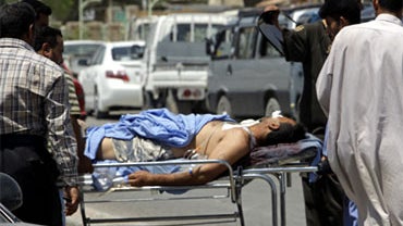 An injured man is carried on a stretcher outside a hospital in Mahmoudiya, Iraq, July 18, 2010. Twin suicide bombings killed scores of people, including dozens from a government-backed, anti-al-Qaida militia lining up to collect their paychecks. 