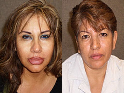 Alejandra Viveros and Guadalupe Viveros, two sisters wanted in connection with silicone implant death in Los Angeles. 