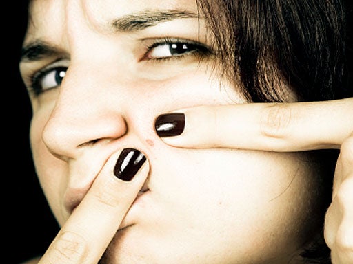 pick, pimple, zit, face, woman, skin care, skin, generic, stock