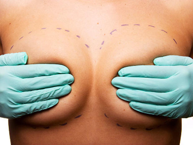 hands, breasts, woman, generic, istockphoto, breast implant, surgery 