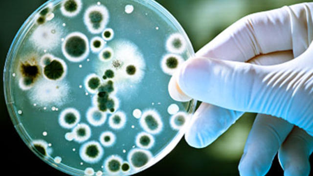 CAROUSEL - Petri dish, bacteria, superbug 