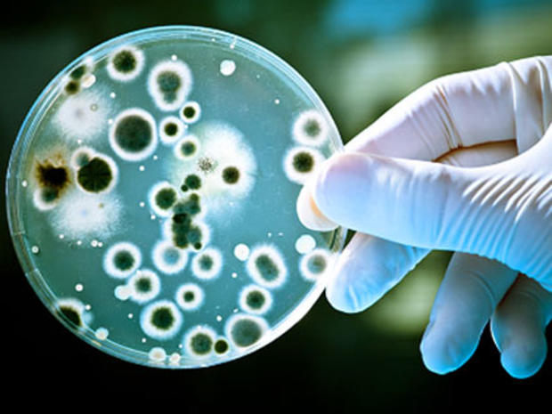 bacteria, petri dish, super bug, superbug 