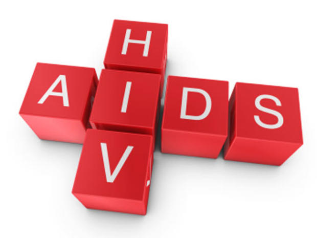 HIV, AIDS 