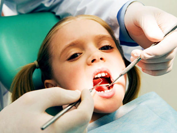 dental sealants, dentist, kid, child, cavity, filling, bpa 