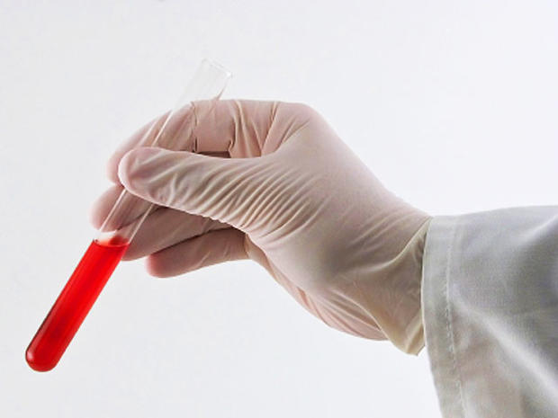 blood test tube 