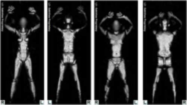 TSA defends full-body scanners at airport checkpoints