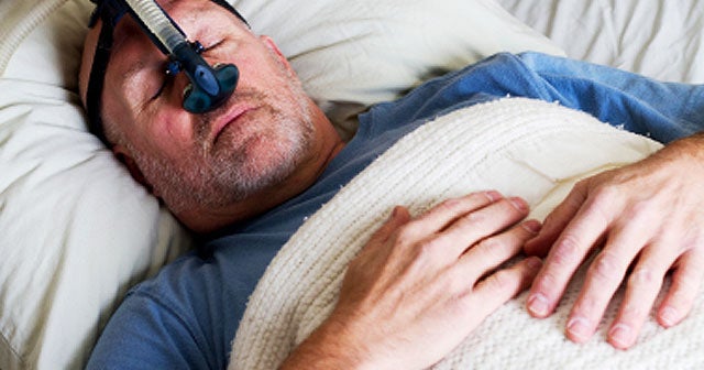 Sleep Apnea "Pacemaker" Zaps Tongue for Better Sleep Will It Work
