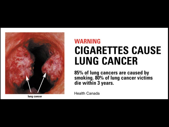 In Your Face: Canada's Tough New Tobacco Warning Labels