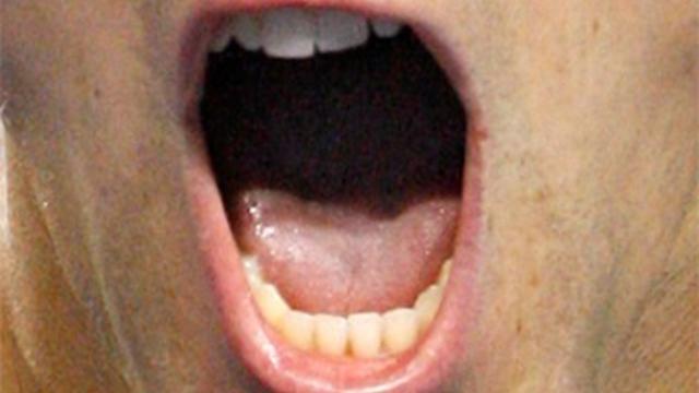 mouth.jpg 