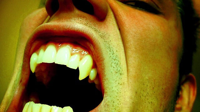 fangs_iStock_000002702504XS_1.jpg 