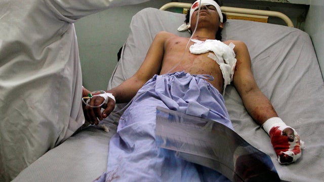 suicide bomber victim 