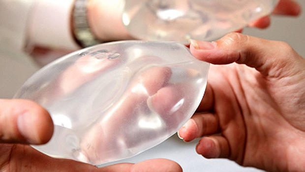 Breast implants: Where they're biggest 
