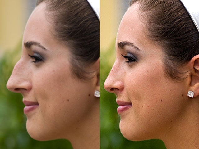 nose_job_iStock_00000713297.jpg 
