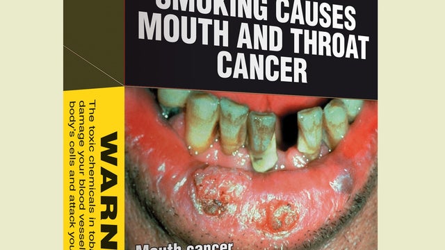 Pack of Australian cigarettes shows graphic images of effects of tobacco 