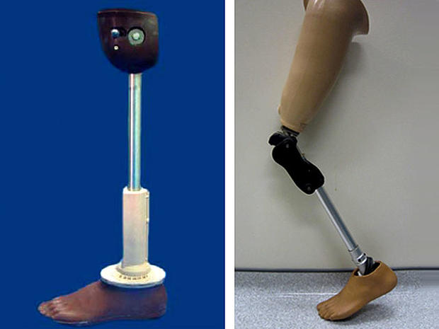 prosthetic_leg.jpg 