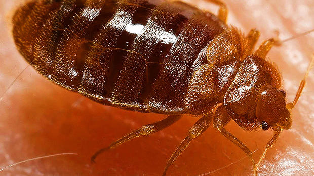 Yikes! Bedbugs!! 15 best bug-busting tips for travelers 