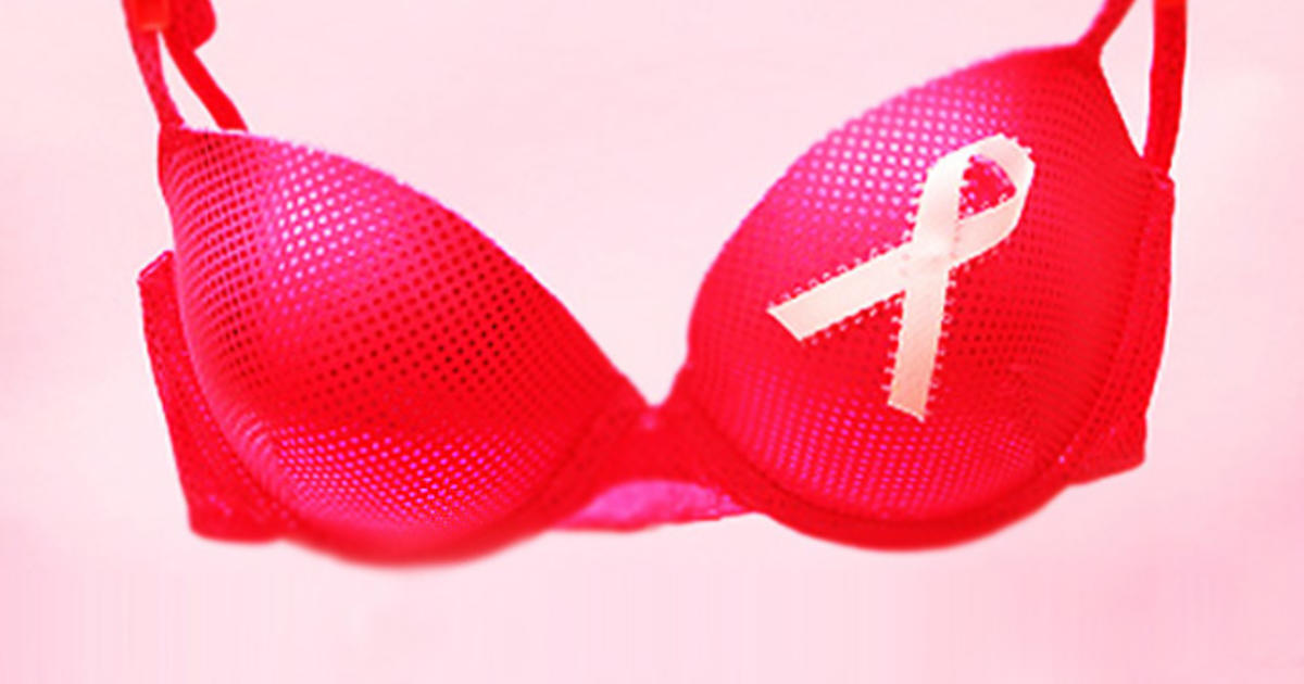 Underwired bras do not compress lymph nodes or cause toxins to