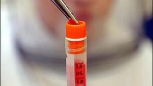 stem-cell-test-tube.jpg 