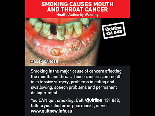 australia-tobaccowarninglabel.jpg 