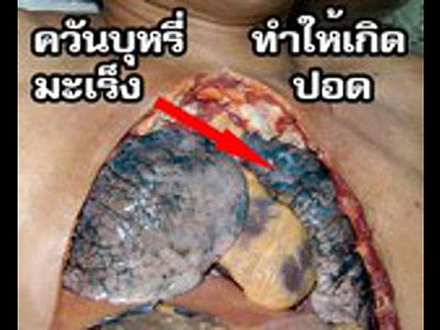 thailand-tobaccowarninglabel.jpg 