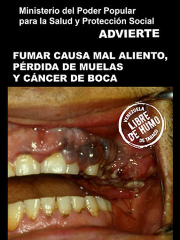 venezuela2-tobaccowarninglabel.jpg 