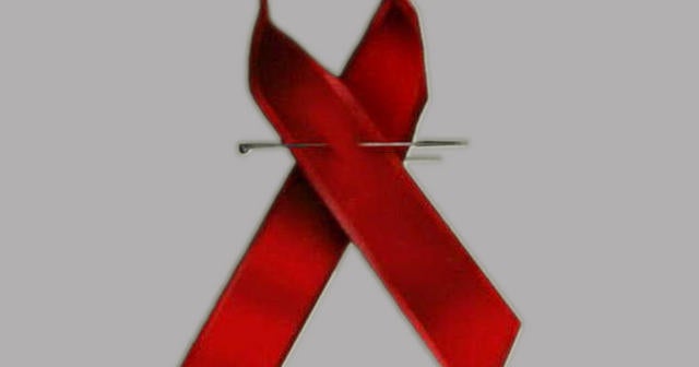 AIDS at 30 - CBS News