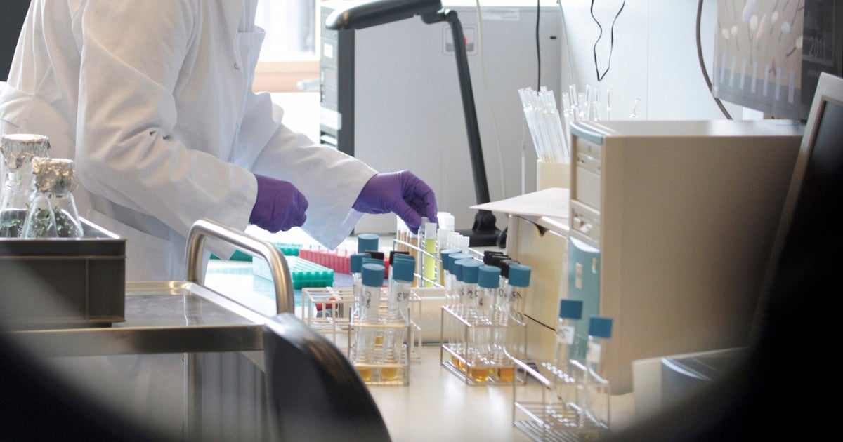 Germany confirms 94 new E. coli cases - CBS News