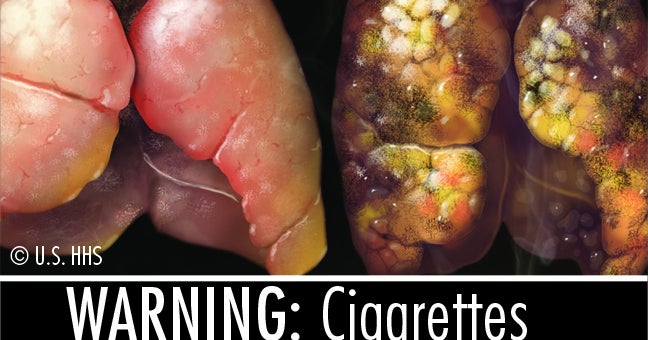 Cigarette warning labels
